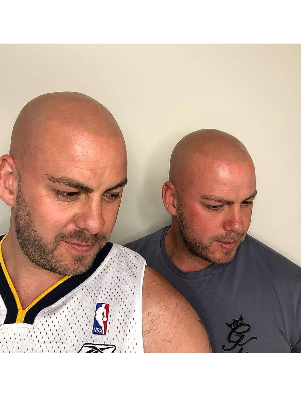 Two bald men with short stubble beards looking down, shaved scalps with even, natural-looking pigmentation