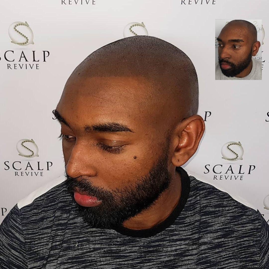 Side view of a man with a closely shaved head and full dark beard, looking down
