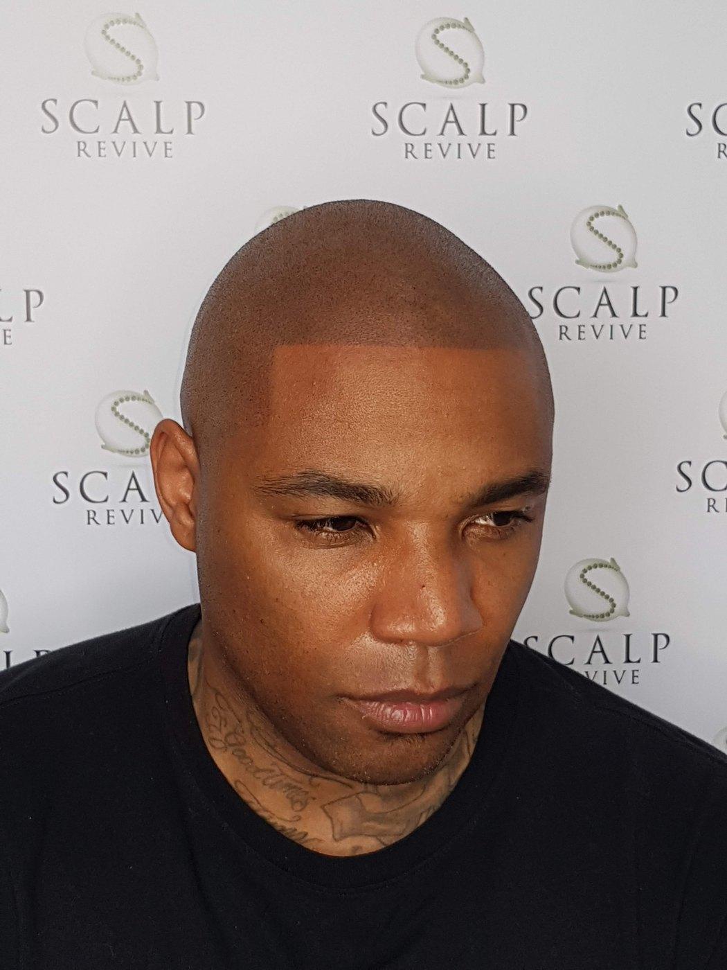 Man with a closely shaved head and defined hairline looking downward, wearing a black top, neck tattoos visible