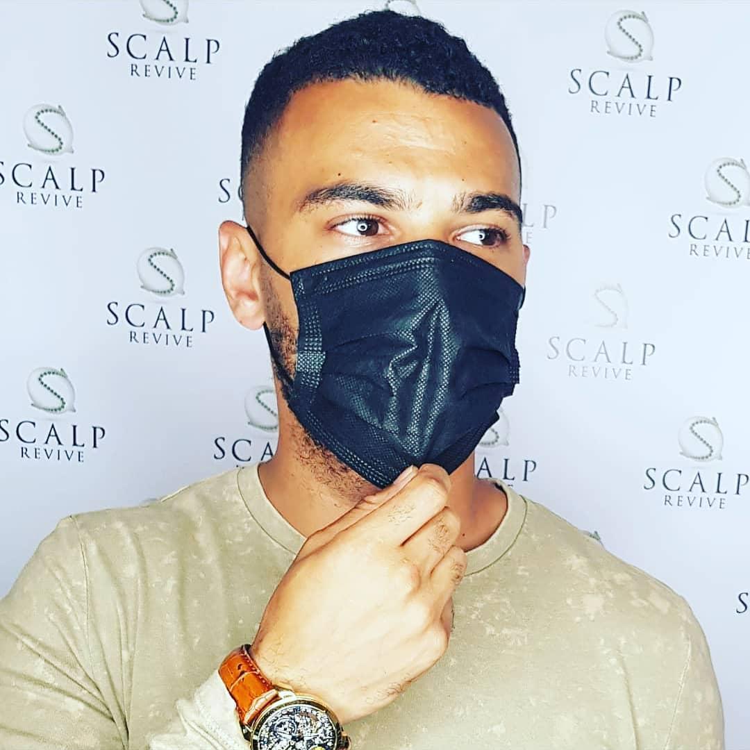 hair tattoo Leeds. scalp micropigmentation Uk. hair tattoo.